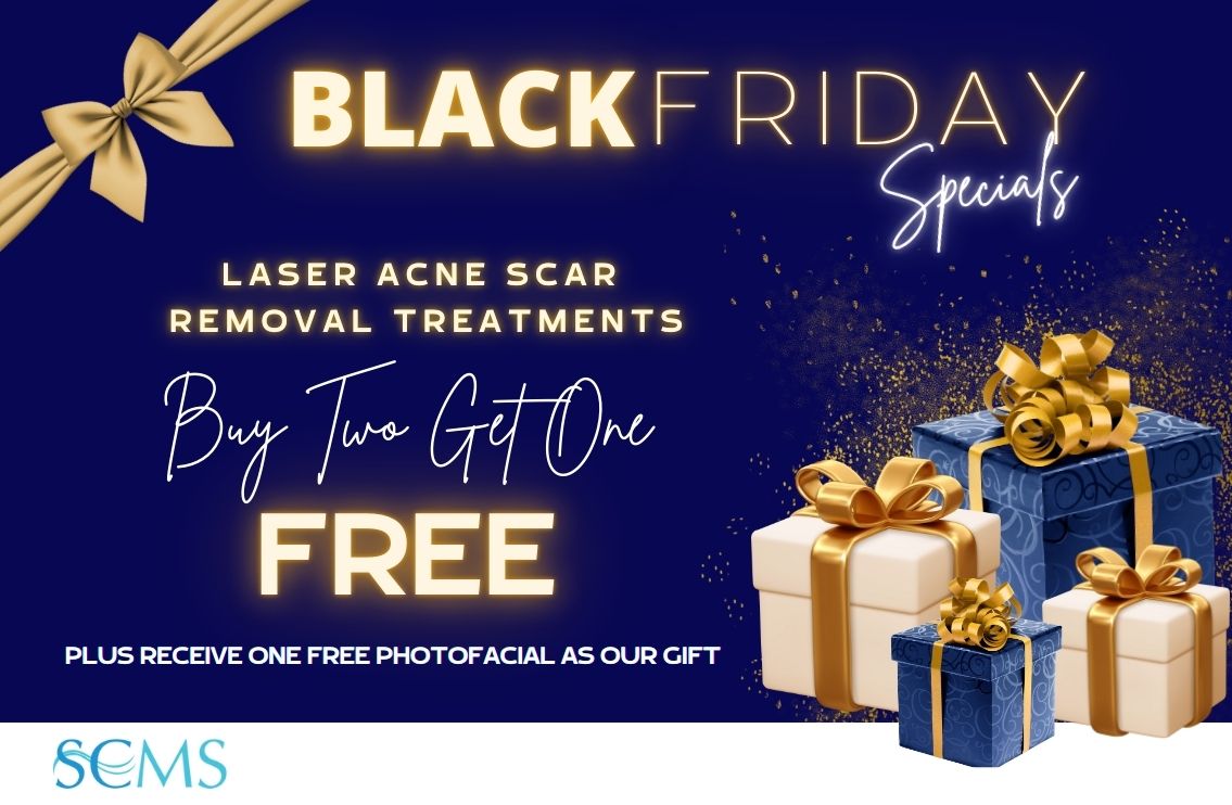 Black Friday Sale - Buy 2 Laser Acne Scar Removal treatments, get 1 free. Plus receive one free BBL photofacial as our gift. Limited time offer.