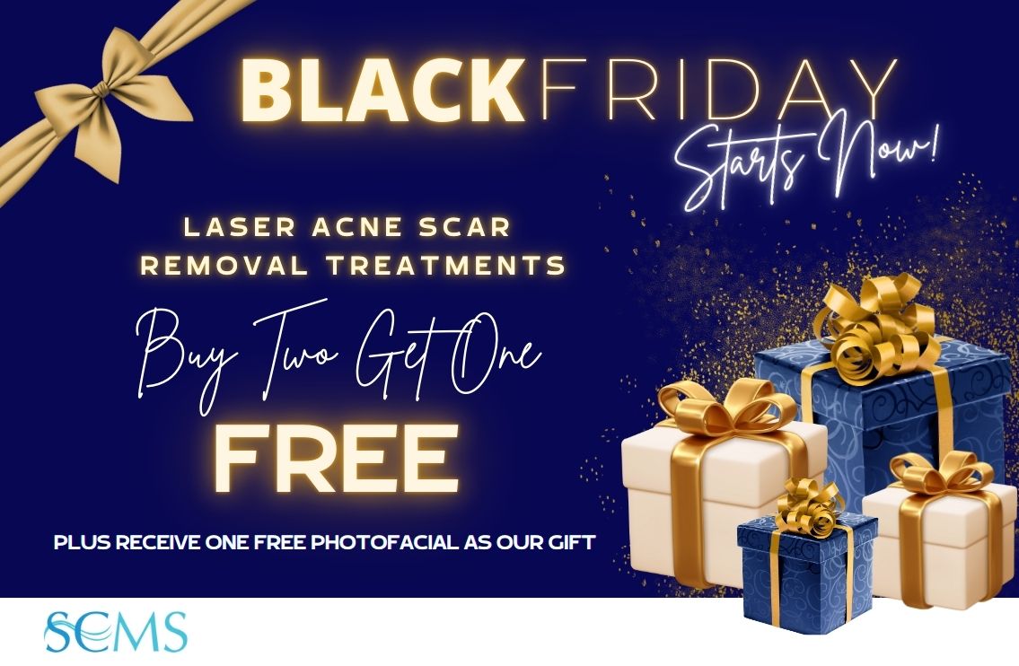 Black Friday Sale - Buy 2 Laser Acne Scar Removal treatments, get 1 free. Plus receive one free BBL photofacial as our gift. Limited time offer.