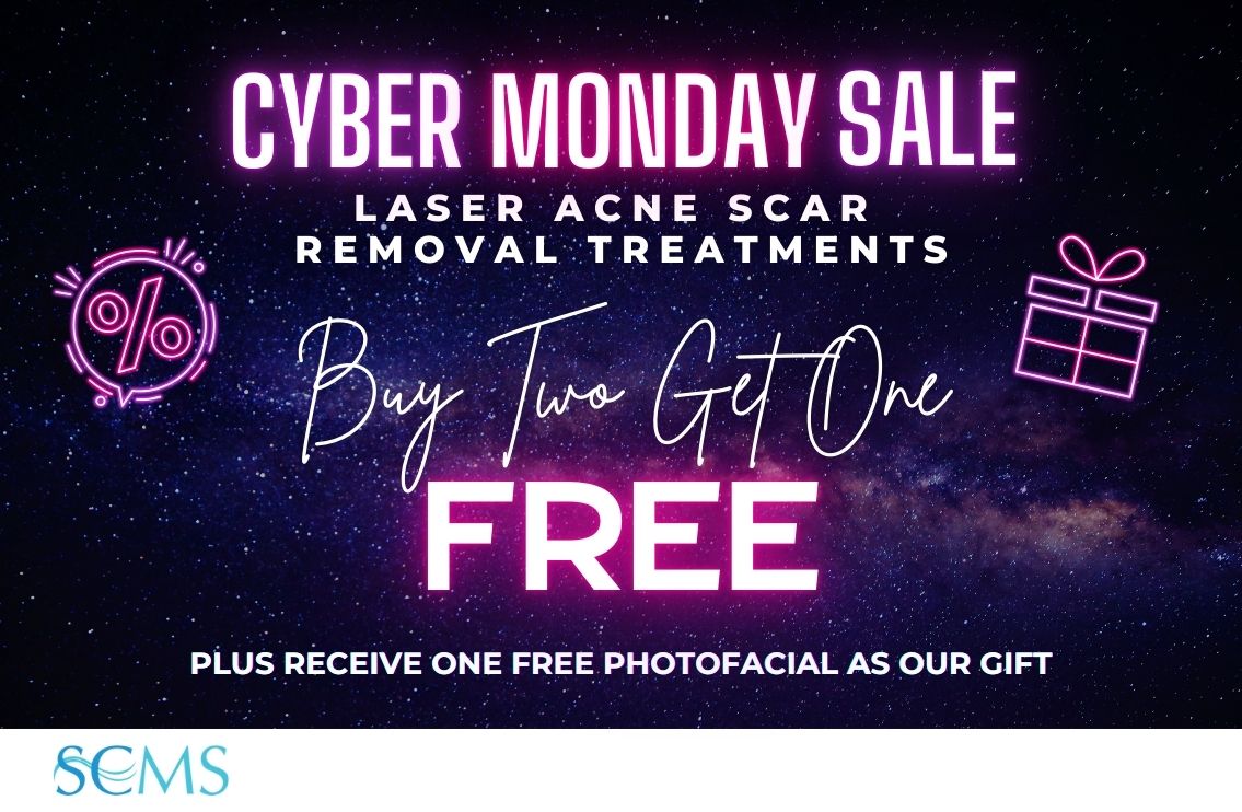 Cyber Monday Sale - Buy 2 Laser Acne Scar Removal treatments, get 1 free. Plus receive one free BBL photofacial as our gift. Limited time offer.