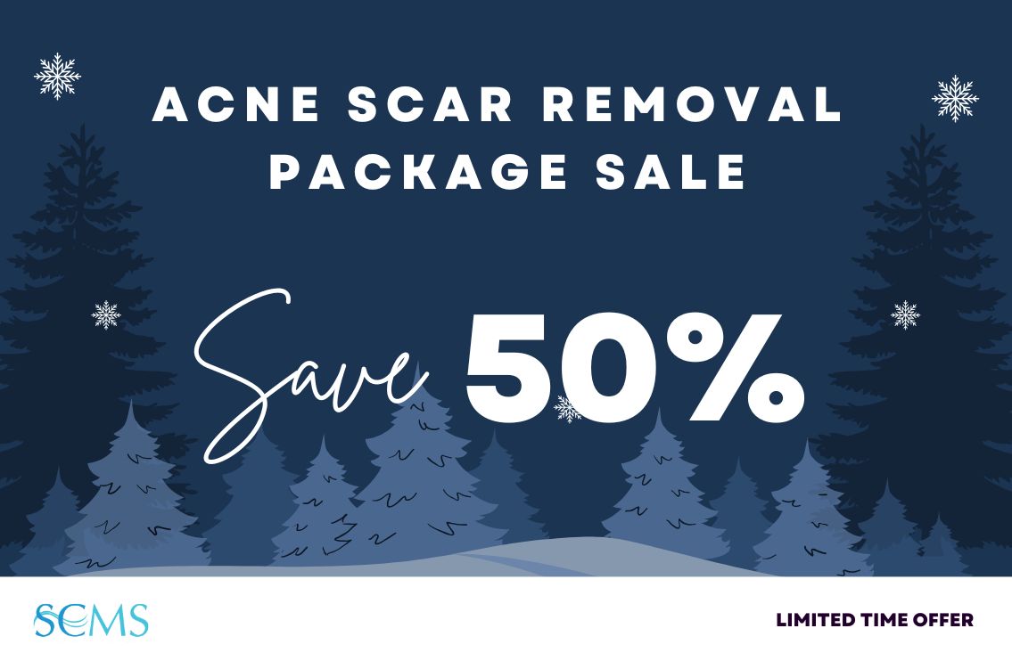 Save 50% off acne sacr removal packages. Limited Time Offer